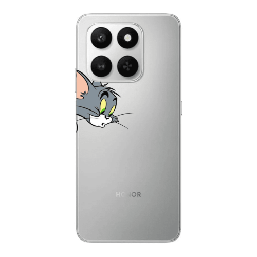 Honor Magic 400 Smart Tom 1 Transparent Silicone TPU Θήκη